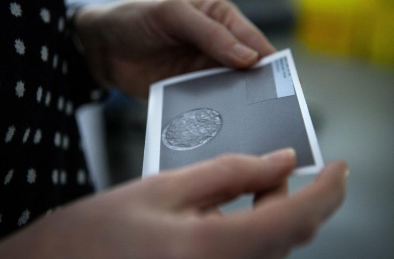Why threats to IVF have these women alarmed: ‘Are they going to make me try and have all those babies?’